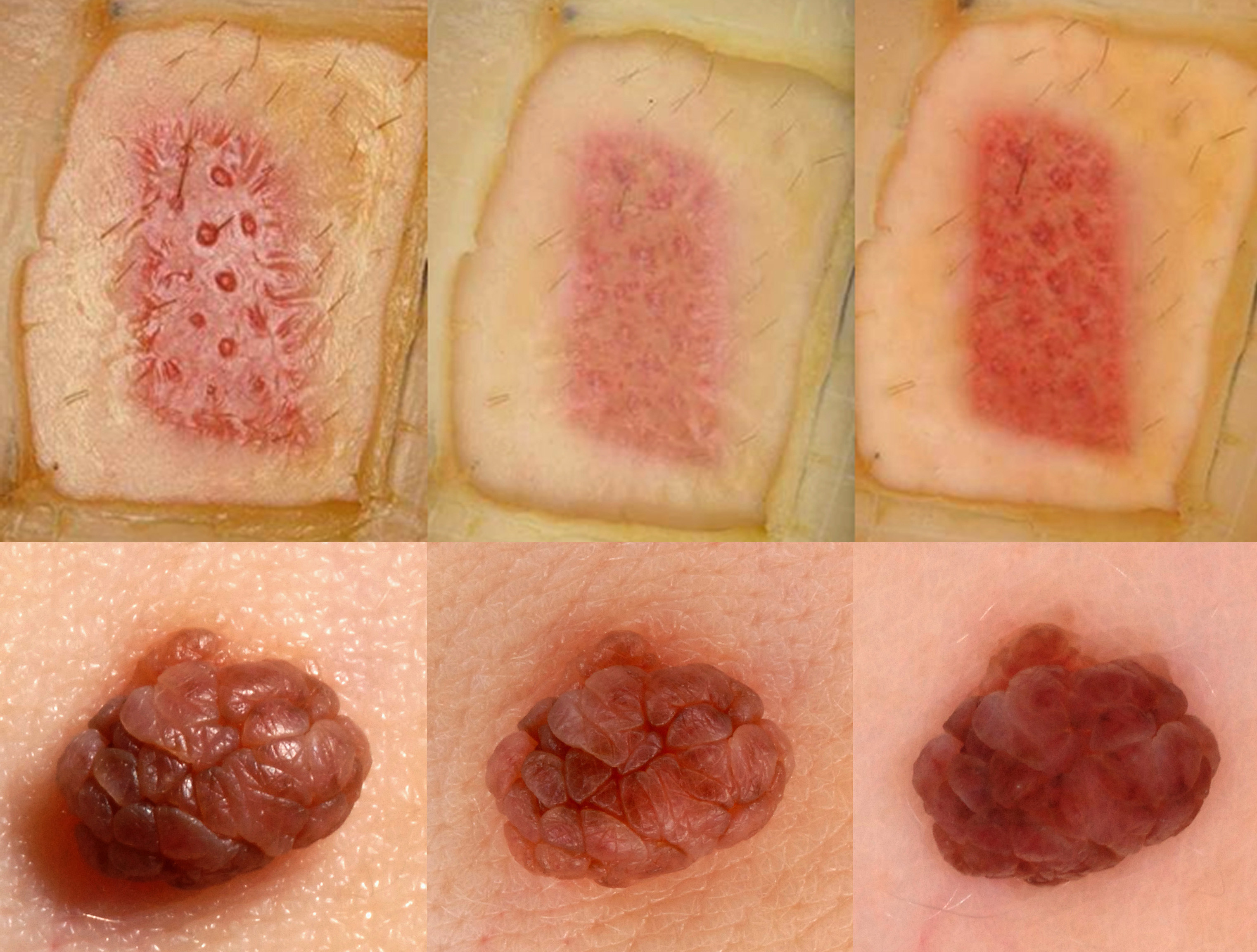 Skin Medical Photography